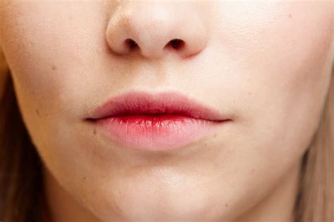 A Dermatologist Answers How Do I Heal My Code Red Level Chapped Lips