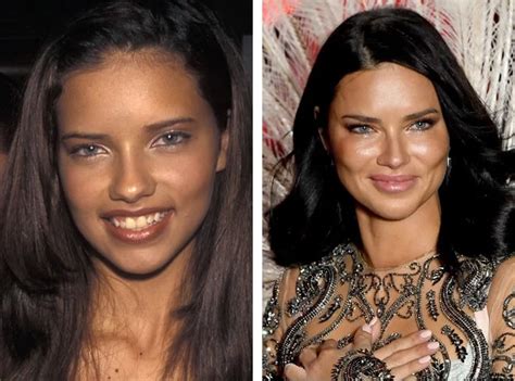Adriana Lima Before And After Plastic Surgery Boobs Nose Face