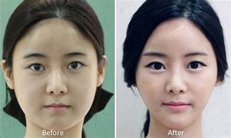 81 Photos Of Plastic Surgery In Korea That Will Make Your Jaw Drop
