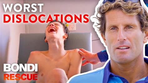 the worst dislocations lifeguards have ever seen youtube