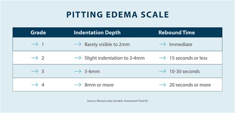 What Is Pitting Edema Tactile Medical 50 Off