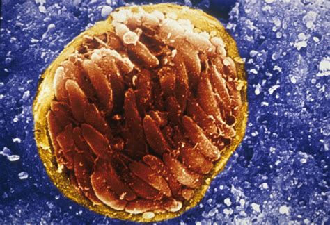 Toxoplasma Gondii Tissue Cyst Image Eurekalert Science News Releases