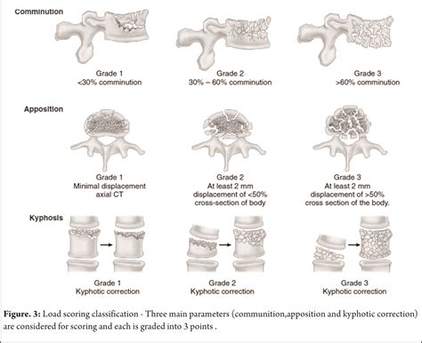 Lumbar Fracture Types