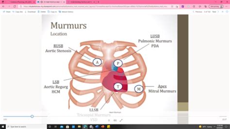 murmur and heart sounds flashcards quizlet