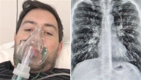 Cystic Fibrosis Survivor Calls For Life Saving Drug Trikafta To Be