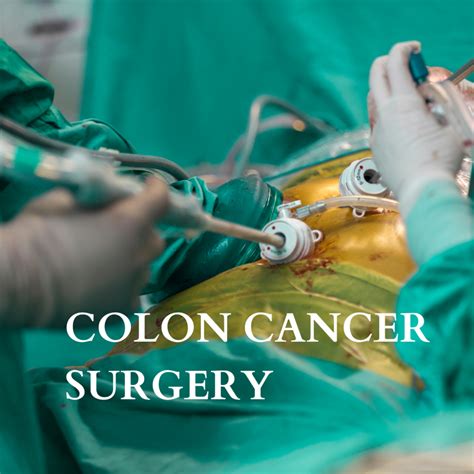Colorectal Cancer Colon Cancer Surgery