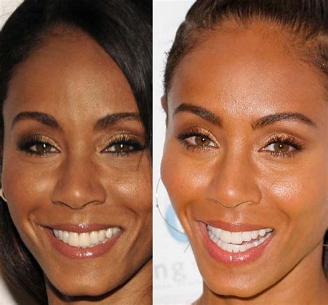 Jada Pinkett Smith Before And After Plastic Surgery 03 Celebrity Plastic Surgery Online