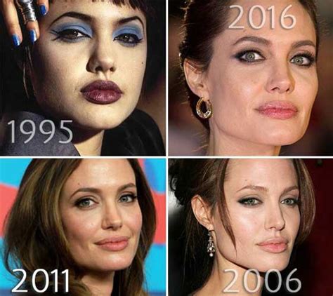 Angelina Jolie Plastic Surgery Nose Jobchin Implantfacelift