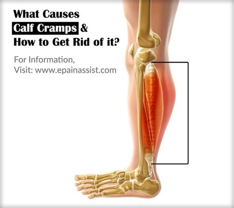 What Causes Calf Cramps How To Get Rid Of It Calf Cramps Calf Muscle Cramps Calf Muscles