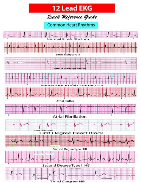 Reading The Heart Ekg Practice Worksheets For Nurses And Medical Students Style Worksheets