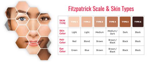 Tipurile de piele în funcție de scala FitzPatrick Chiar și pe pielea