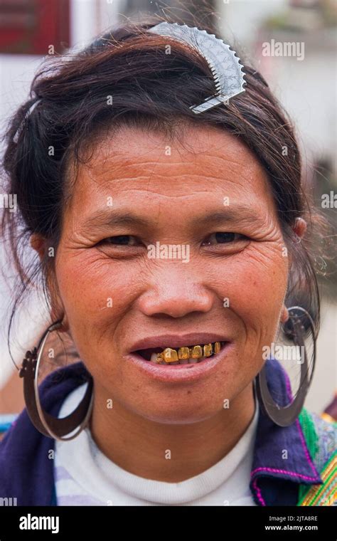 Gold Tooth Vietnam Hi Res Stock Photography And Images Alamy