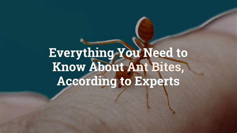 Everything You Need To Know About Ant Bites According To Experts