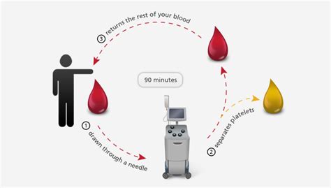 Platelets Donation Process Irish Blood Transfusion Service