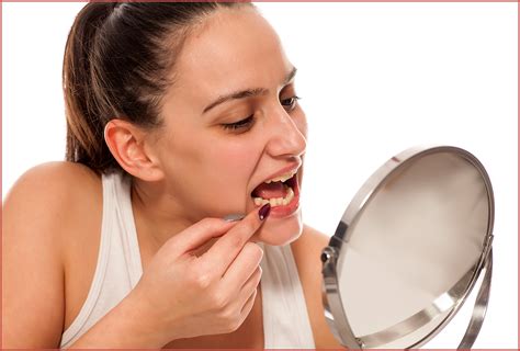 Diastema Gap Between Teeth Causes And Treatment