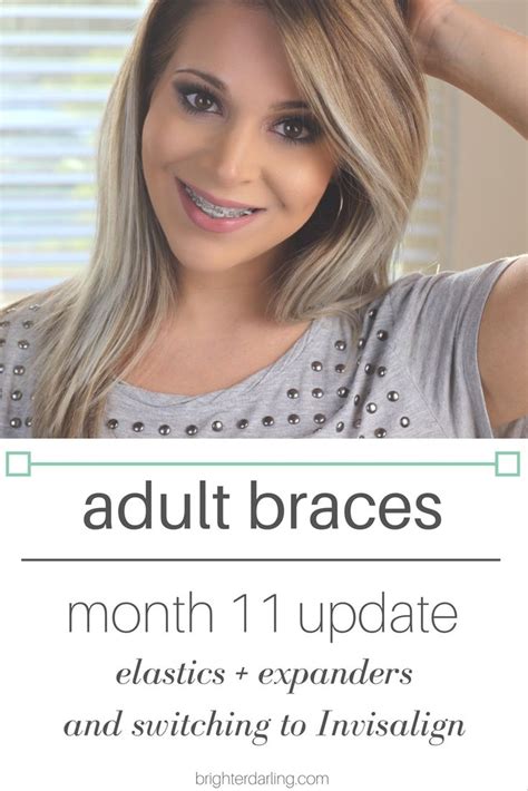 Adult Braces Month 11 Update Artofit