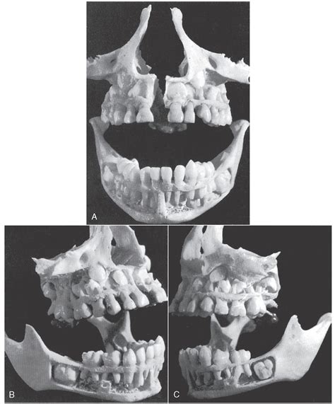 Root Development In Permanent Teeth