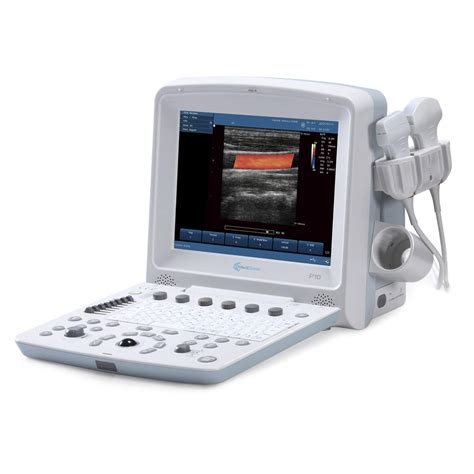 Portable Ultrasound System P10 Medisono For Multipurpose