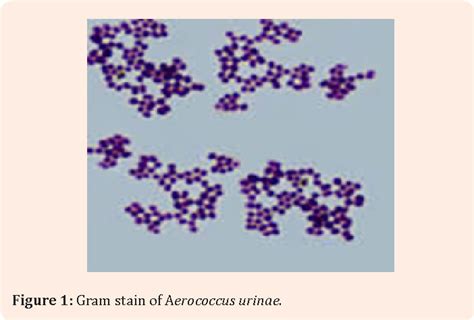 A Case Of Urinary Tract Infection Caused By Aerococcus Urinae