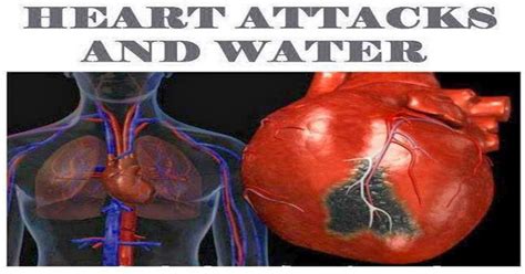 Heart Attacks And Water Wise Thinks