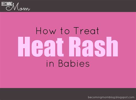Becoming Mom Heat Rash What It Is And How To Treat It
