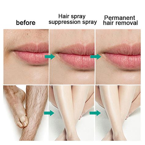 2 Bottles Hair Removal Cream Spray Body Private Parts Armpit Leg Hair