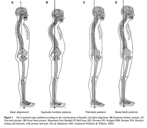 Posture Category Back To Life Chiropractic
