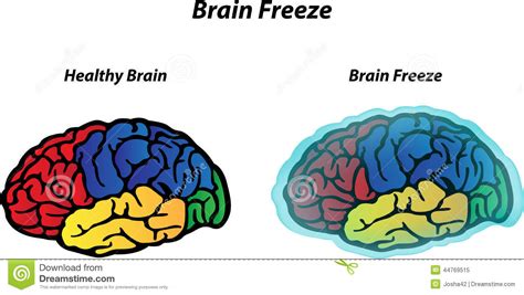 Brain Freeze Stock Vector Illustration Of Anatomy Brain 44769515