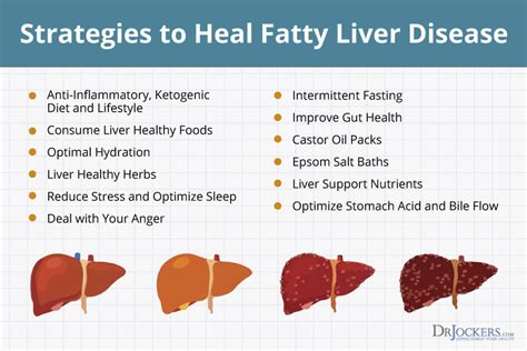 Fatty Liver Symptoms Causes And Natural Support Strategies Fatty