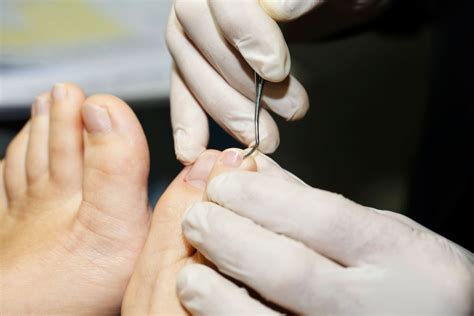 10 Signs Of Disease Your Feet Can Reveal Readers Digest