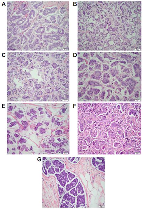 Full text Molecular and immunohistochemical profiling of ...