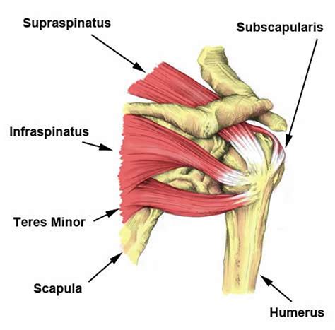 The subacromial bursa lies on the superior aspect of the supraspinatus tendon (see the images below). Anterior shoulder pain causes, symptoms, diagnosis & treatment