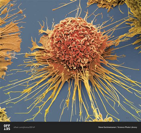 Activated Human Macrophage Under A Color Scanning Electron Micrograph