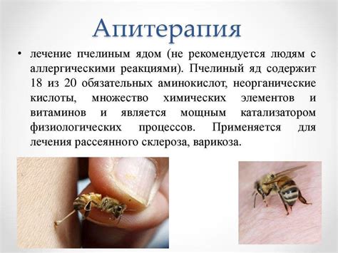 Лечение укусами пчёл – апитерапия в домашних условиях