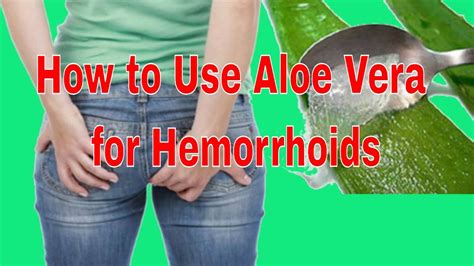 Hemorrhoids Treatment How To Use Aloe Vera For Hemorrhoids The