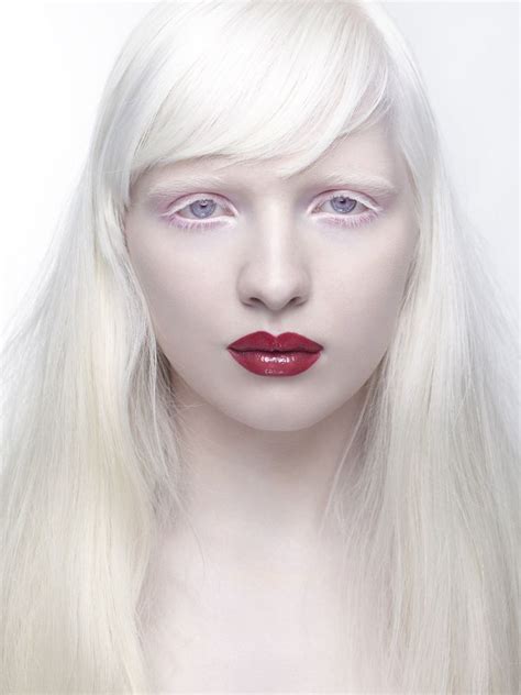 Nastya Zhidkova Albino Model Albino Girl Albinism Hot Sex Picture