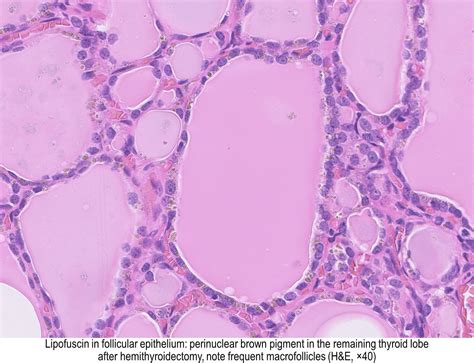 Thyroid Gland Histology Thyroid Histology Slide
