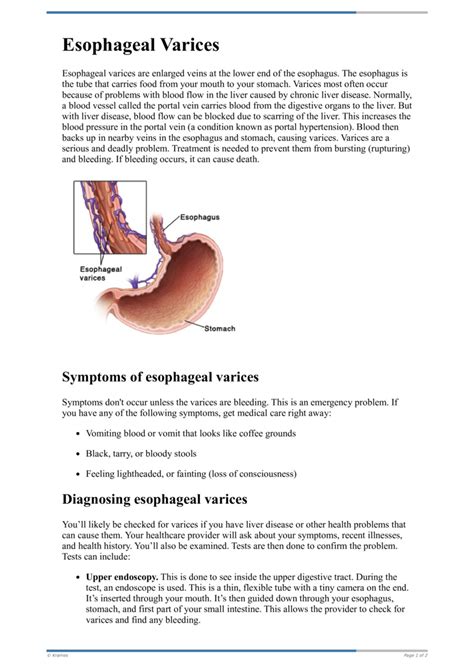 Text Esophageal Varices Healthclips Online