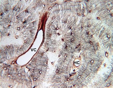 Osteocyte processes lie in tiny canals (canaliculi) in the bone matrix. compact bone | anatomy | Britannica.com