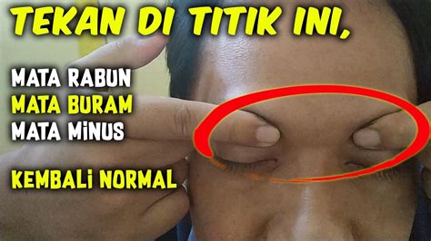 CARA PIJAT MATA RABUN MATA BURAM LANGSUNG TERANG TANPA MINUM OBAT