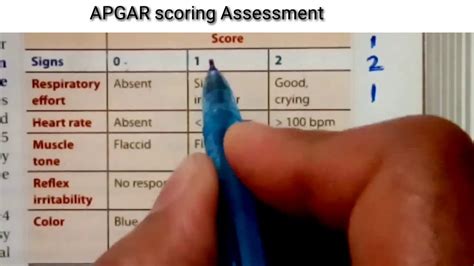 Newborn Assessment Apgar For Newborns Apgar Scoring Apgar Scale