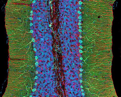 New Invention Reveals Cells Signaling Pathways In Living Brains