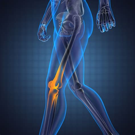 Treating Chronic Knee Pain Louisville Orthopedic Surgeon