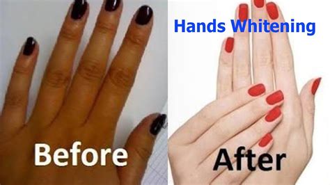 Hands Whitening Get Soft Hands Without Dryness Wrinkles And