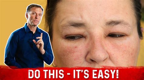 How To Fix The Swollen Face Facial Puffiness And Puffy Eyes Drberg