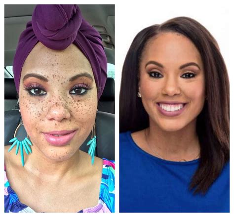 ABC 13 anchor 'frees' her freckles to show natural beauty