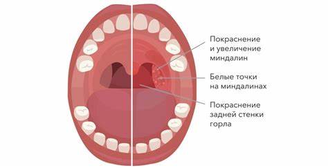 Диета неприятный запах изо рта Диета неприятный запах изо рта