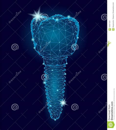 ← back to model page. Molar Tooth Dental Implant 3d Low Poly Geometric Model ...