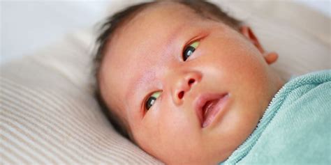 How To Know If My Baby Has Neonatal Jaundice Healthnews