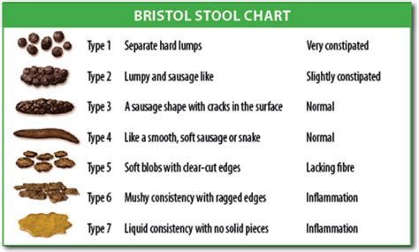 Identifying Types Of Poop With The Bristol Stool Chart And 50 Off